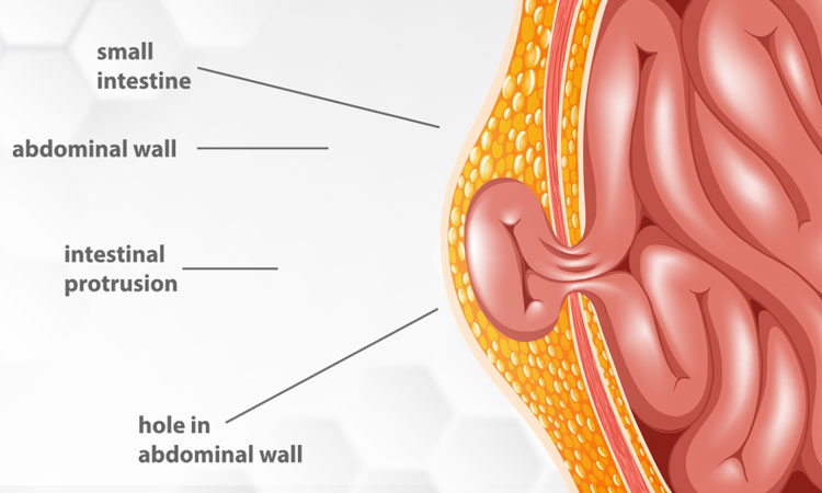 Laparoscopic Specialist Maharashtra